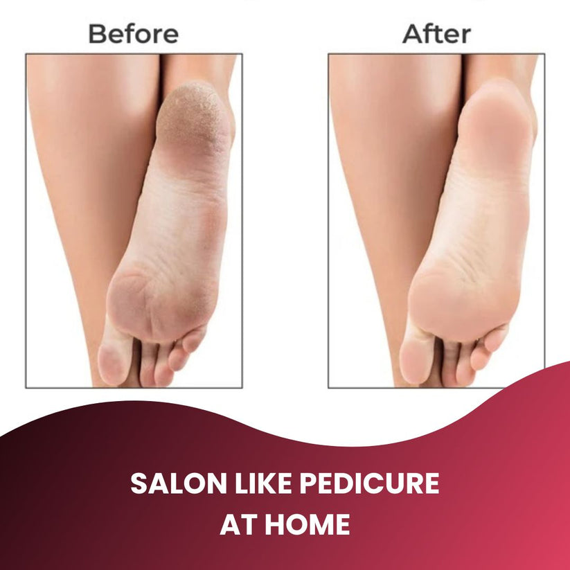 Portable Pedicure Callus Dead Skin Removing Tool